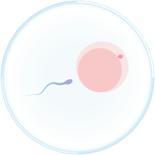 PGD illustration