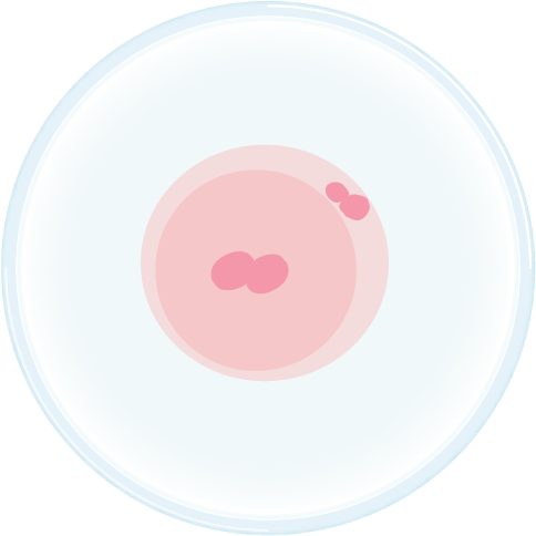 PGD illustration