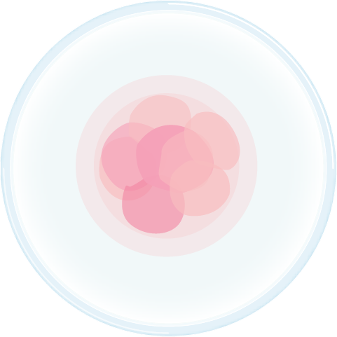 PGD illustration