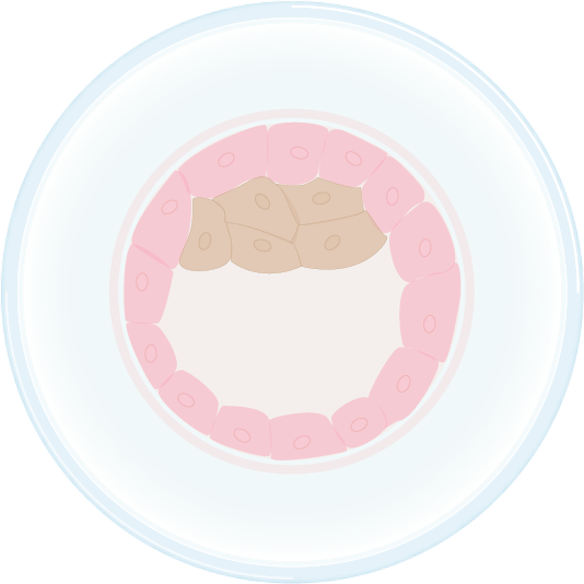 PGD illustration